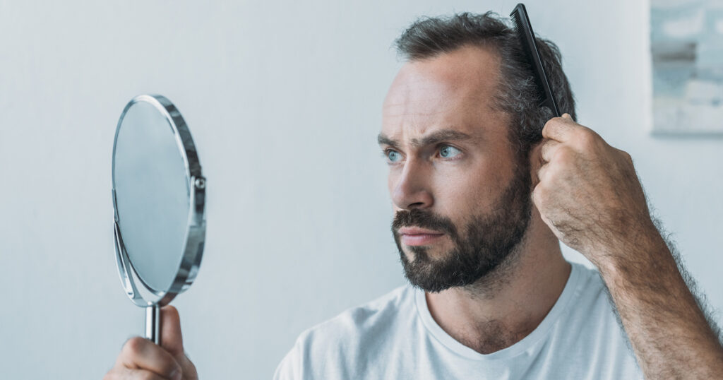 Homme qui perd ses cheveux